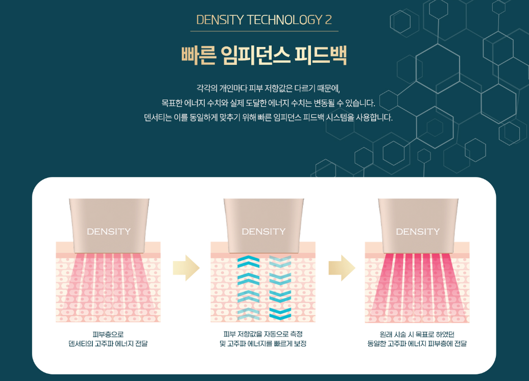 덴서티 고주파리프팅 광주피부과 닥터에버스 덴서티 고주파리프팅 광주피부과 닥터에버스